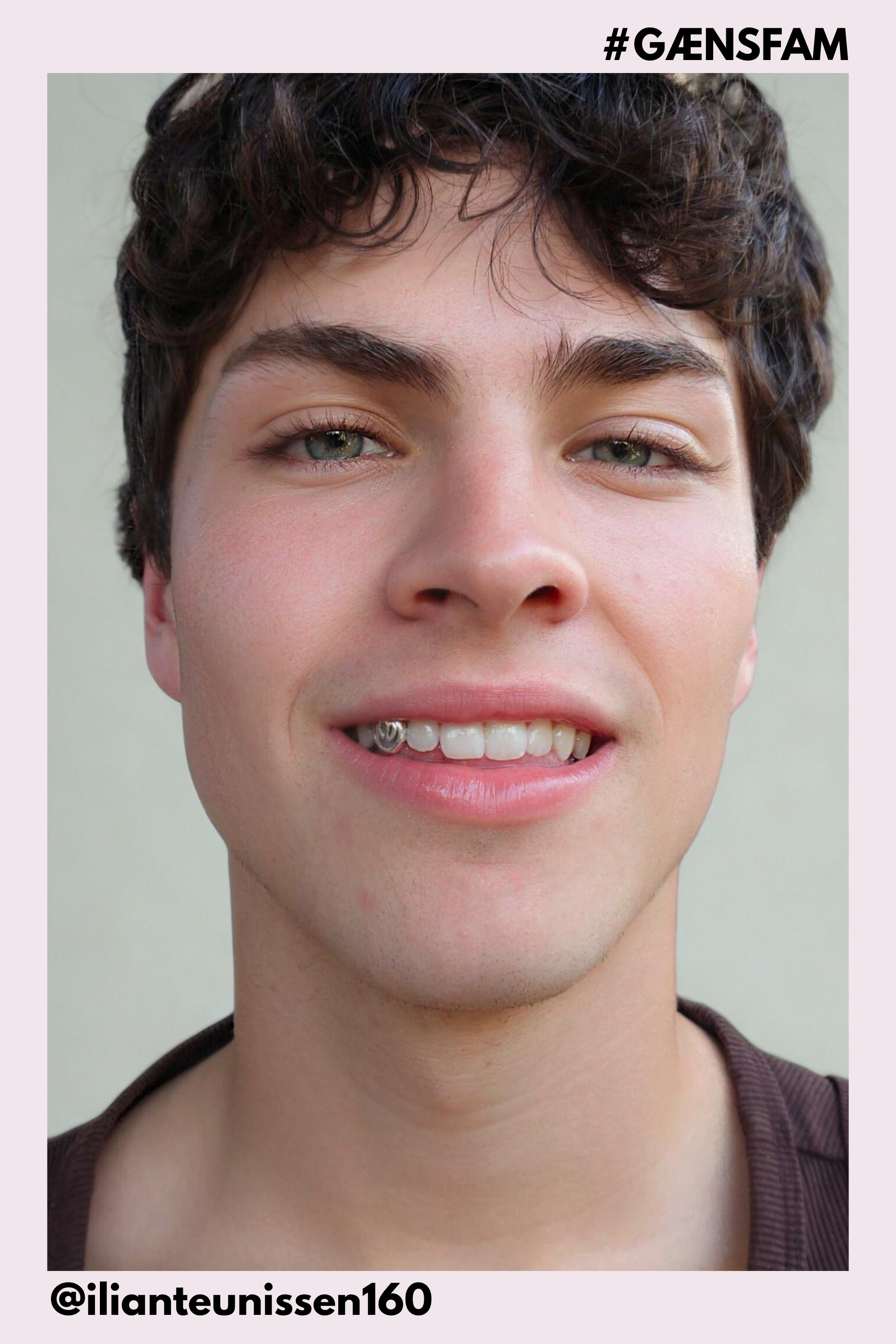 Down Payment For Grillz (includes dental mould kit)