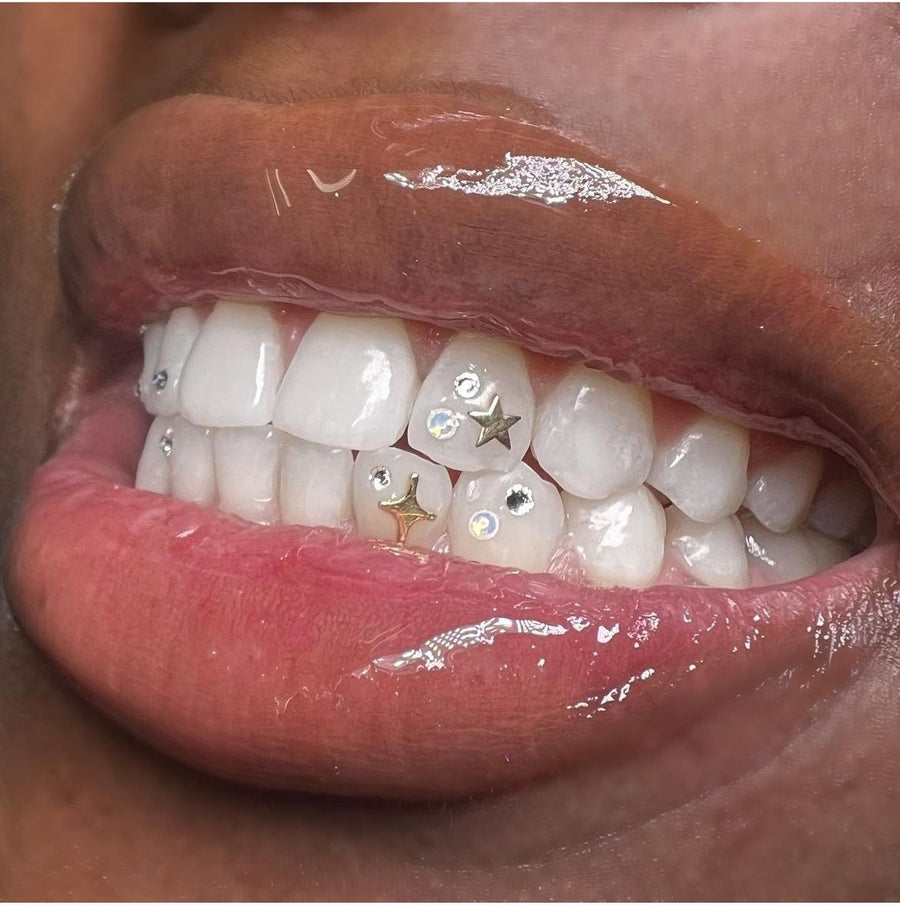 Tooth gem gallery 1